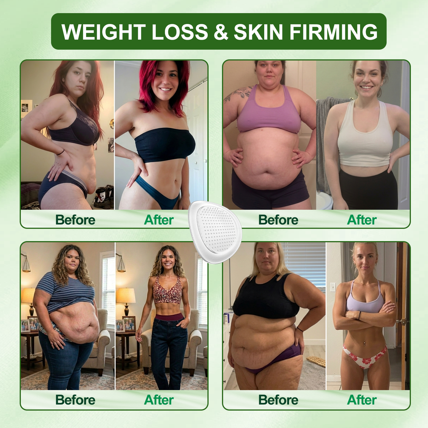 [𝟐𝟎𝟐𝟔 𝐍𝐞𝐰 & 𝐔𝐩𝐠𝐫𝐚𝐝𝐞𝐝: 𝟖𝟎% 𝐎𝐅𝐅] ✅ 𝐃𝐑.𝐇𝐎𝐍𝐎𝐑® 𝐋𝐲𝐦𝐩𝐡𝐚𝐭𝐢𝐜 𝐃𝐫𝐚𝐢𝐧𝐚𝐠𝐞 𝐒𝐥𝐢𝐦𝐦𝐢𝐧𝐠 𝐍𝐚𝐧𝐨-𝐌𝐢𝐜𝐫𝐨𝐧𝐞𝐞𝐝𝐥𝐞 𝐏𝐚𝐭𝐜𝐡: 𝐔𝐥𝐭𝐫𝐚-𝐏𝐨𝐭𝐞𝐧𝐭 𝟓× 𝐅𝐨𝐫𝐦𝐮𝐥𝐚 𝐰𝐢𝐭𝐡 𝐋𝐢𝐩𝐨𝐥𝐲𝐭𝐢𝐜 𝐏𝐞𝐩𝐭𝐢𝐝𝐞 𝐂𝐨𝐦𝐩𝐥𝐞𝐱 — 𝐒𝐮𝐩𝐩𝐨𝐫𝐭𝐬 𝐖𝐞𝐢𝐠𝐡𝐭 𝐋𝐨𝐬𝐬 & 𝐋𝐲𝐦𝐩𝐡𝐚𝐭𝐢𝐜 𝐅𝐥𝐨𝐰 — 𝐏𝐥𝐮𝐬 𝐉𝐨𝐢𝐧𝐭 𝐑𝐞𝐥𝐢𝐞𝐟, 𝐁𝐞𝐭𝐭𝐞𝐫 𝐒𝐥𝐞𝐞𝐩 & 𝐌𝐞𝐧𝐭𝐚𝐥 𝐂𝐥𝐚𝐫𝐢𝐭𝐲.